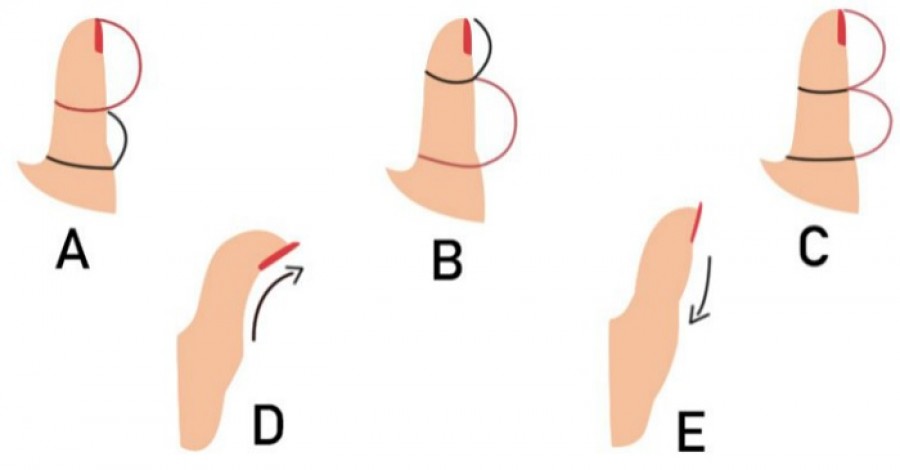 A hüvelykujjad formája sok mindent elárul a személyiségedről